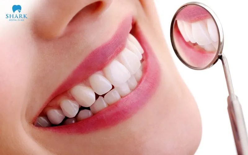 Porcelain fillings are highly regarded because they have a natural color and a high level of aesthetic quality