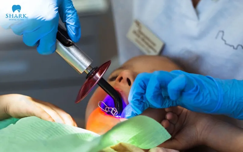 Among the advantages of laser root canal treatment is the way it helps to reduce pain and discomfort