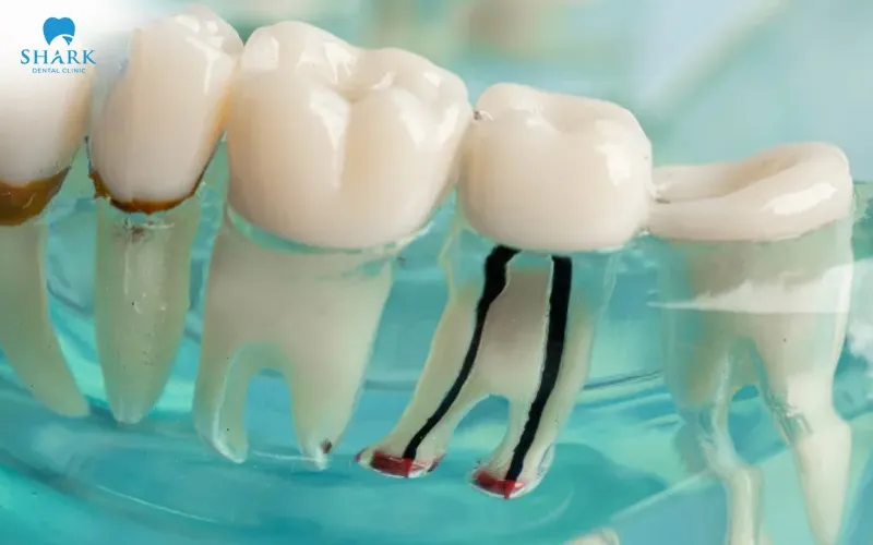 This method helps to improve the healing of the area and to bring about a faster recovery