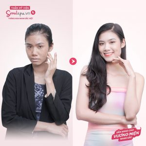 SeoulSpa.Vn giúp diện mạo xinh đẹp và cuốn hút không lo về giá