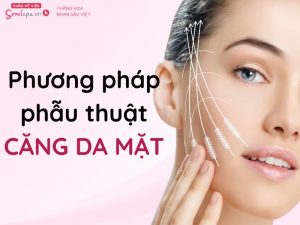 Phương pháp phẫu thuật căng da mặt bằng chỉ tại Thẩm mỹ viện SeoulSpa.Vn