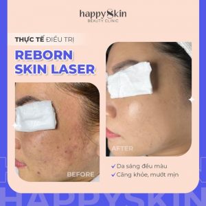 Happy Skin Medical Spa chuyên về dịch vụ chăm sóc, điều trị da