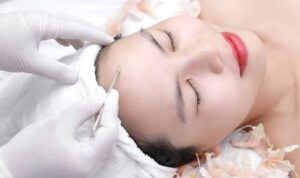 Những spa trị mụn Rạch Giá được nhiều người ưu tiên lựa chọn