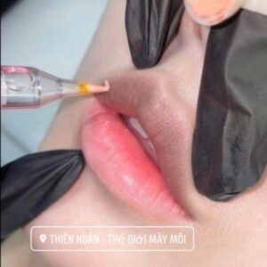 Thiên Ngân Spa có thể xử lý tình trạng môi thâm