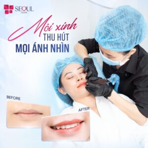 Seoul Center sử dụng công nghệ phun xăm tiên tiến từ Châu Âu