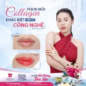 Seoul Center mang đến quy trình phun xăm chuẩn Y khoa