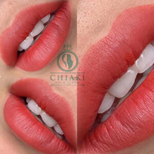 Viện Thẩm Mỹ ChiaKi luôn cam kết dịch vụ thẩm mỹ chuẩn xác cho phái đẹp