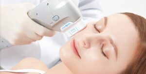 Chi phí thực hiện nâng cơ mặt RF trong khoảng 4 - 5 triệu đồng