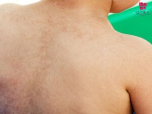 Lông măng là gì? Có mấy cách xử lý lông măng an toàn và hiệu quả tại nhà? Cùng dichvuspa.com.vn theo dõi dưới đây