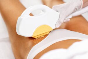 Triệt lông vùng kín bằng công nghệ Nano Laser hiện đại