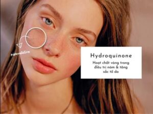 Những kem trị nám có chứa Hydroquinone được các tín đồ skincare yêu thích