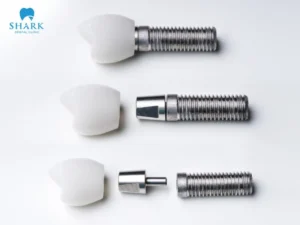 Dental implants at Shark Dental Clinic