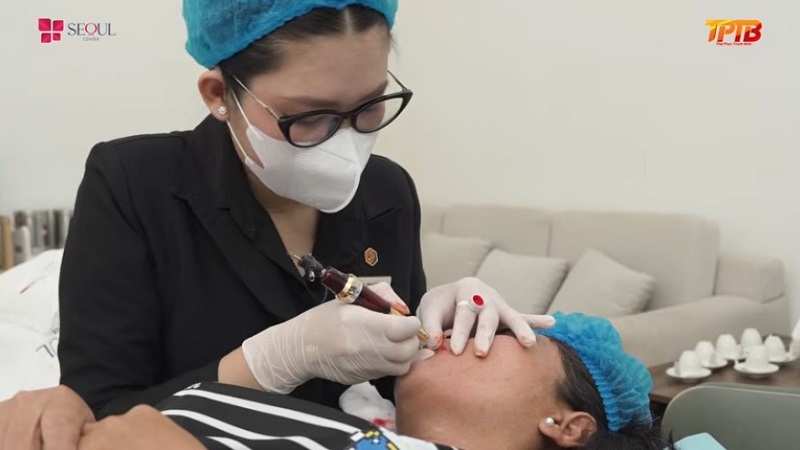 Đội ngũ kỹ thuật viên tỉ mỉ đưa mực vào môi giúp chị Banh sở hữu đôi môi đẹp rạng rỡ ưng ý nhất