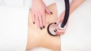 Những công nghệ giảm béo không xâm lấn phổ biến là gì?