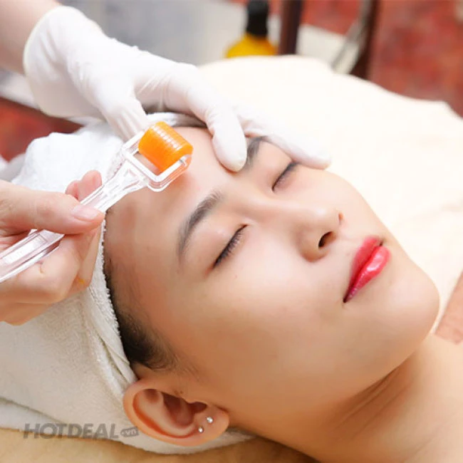 Lăn kim vi điểm là kỹ thuật gì cho da?