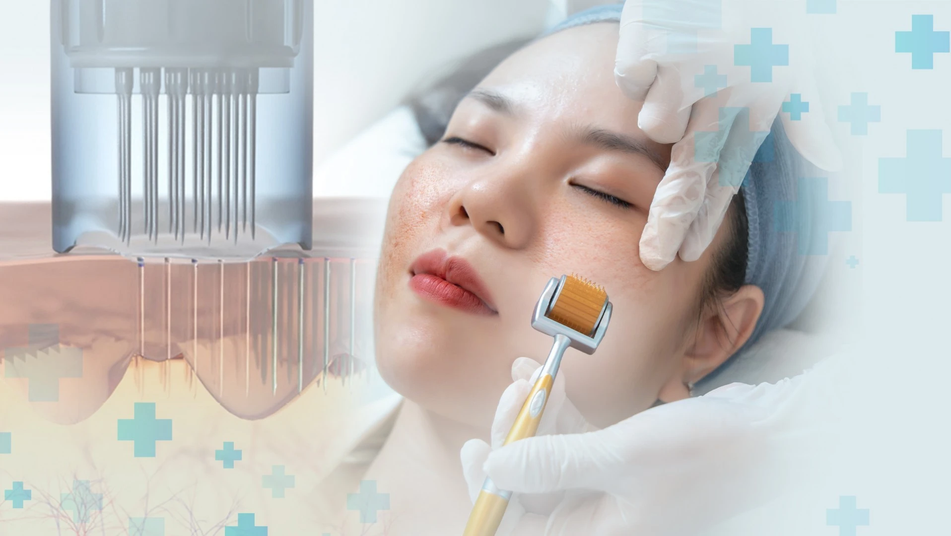 Cách chọn loại kim lăn và lịch trình phù hợp da của bạn?