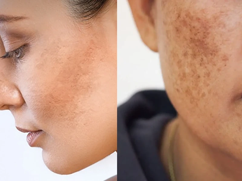Khi nào nên gặp bác sĩ da liễu?