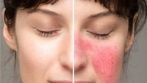 Khi nào cần gặp bác sĩ da liễu?