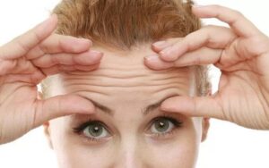 Cách giảm nếp nhắn vùng trán tại nhà