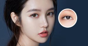 Bọng mắt cười được xem là xu hướng làm đẹp phổ biến tại Hàn Quốc