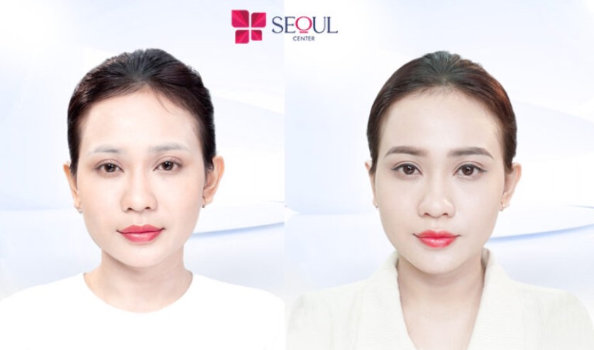 Thẩm mỹ viện Seoul Center chinh phục khách hàng bằng công nghệ phun mày hiện đại và đội ngũ nhân viên chuyên nghiệp