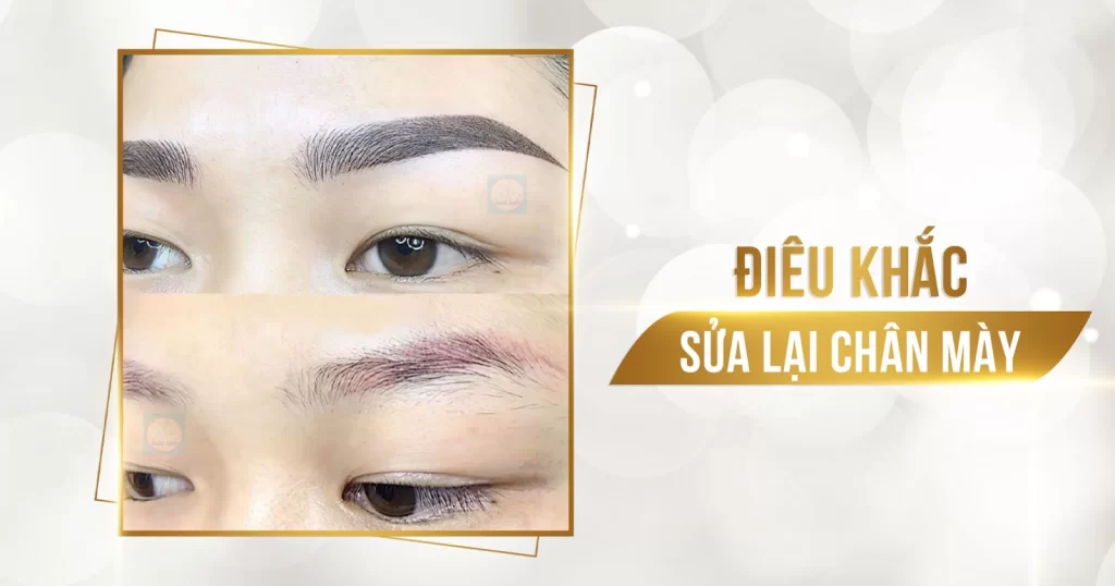 Dáng mày được đo vẽ chuẩn tỷ lệ vàng – quy trình chuẩn mực tại Thẩm mỹ viện Hoài Anh