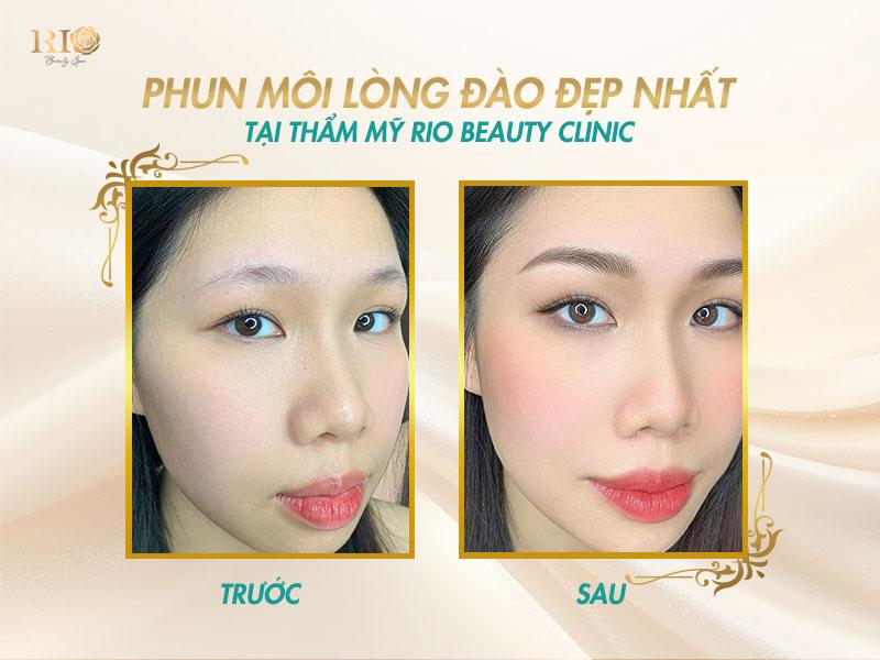 Môi căng mọng, tươi tắn chỉ sau 1 buổi