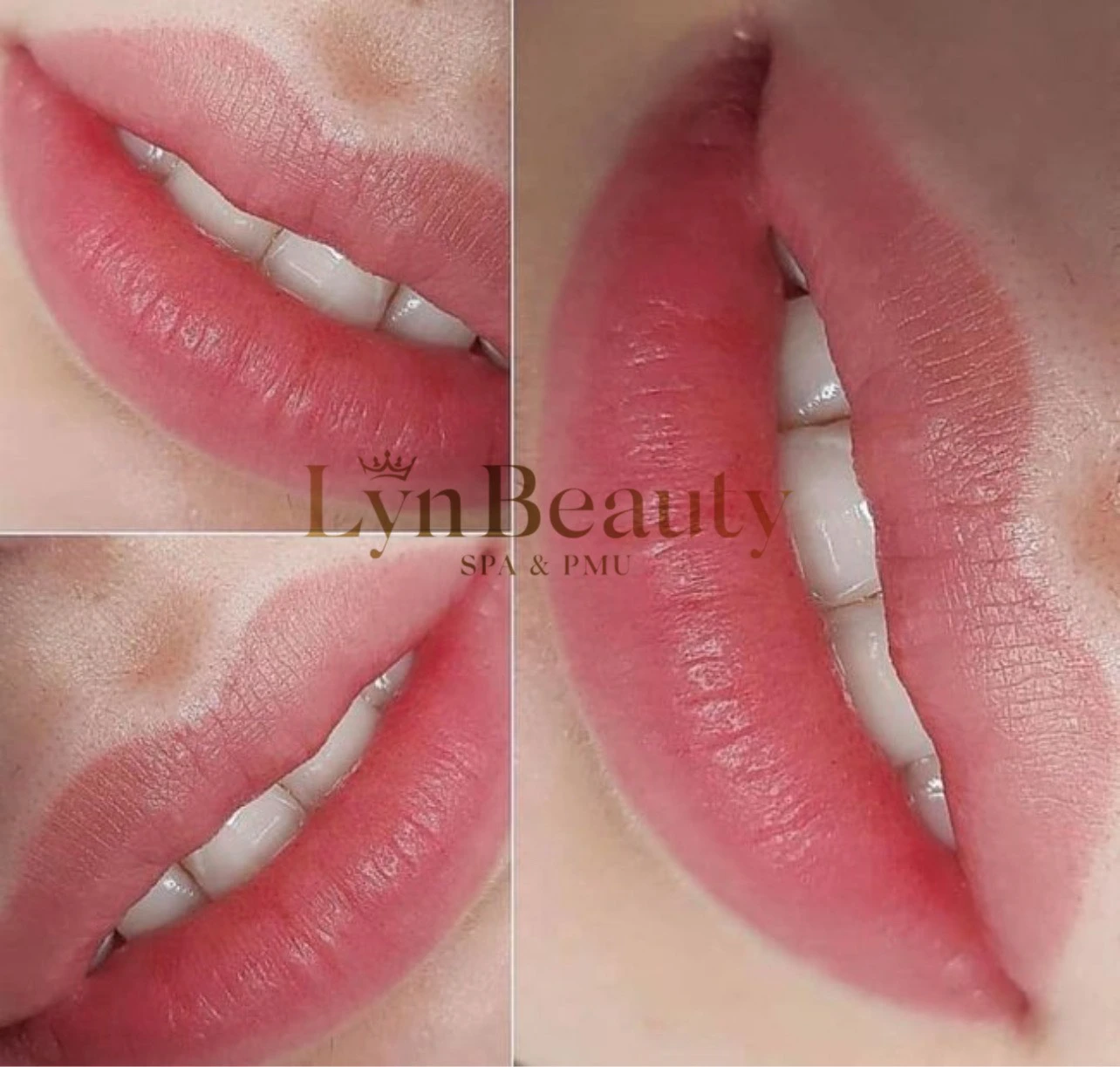 Lym Beauty & Spa sở hữu đội ngũ nhân viên chuyên nghiệp, nhiệt tình