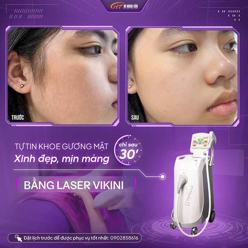 Thẩm mỹ Hoàng Tuấn sở hữu trang thiết bị hiện đại, mang lại hiệu quả cao sau làm đẹp