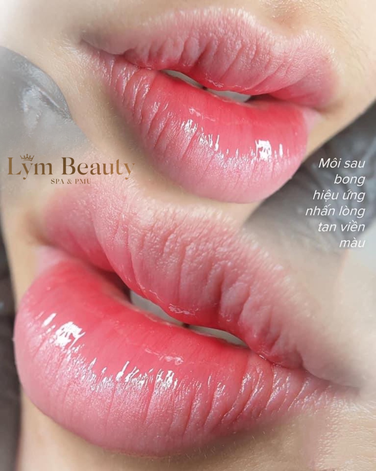 Lym Beauty & Spa nổi bật với đội ngũ chuyên viên tay nghề cao