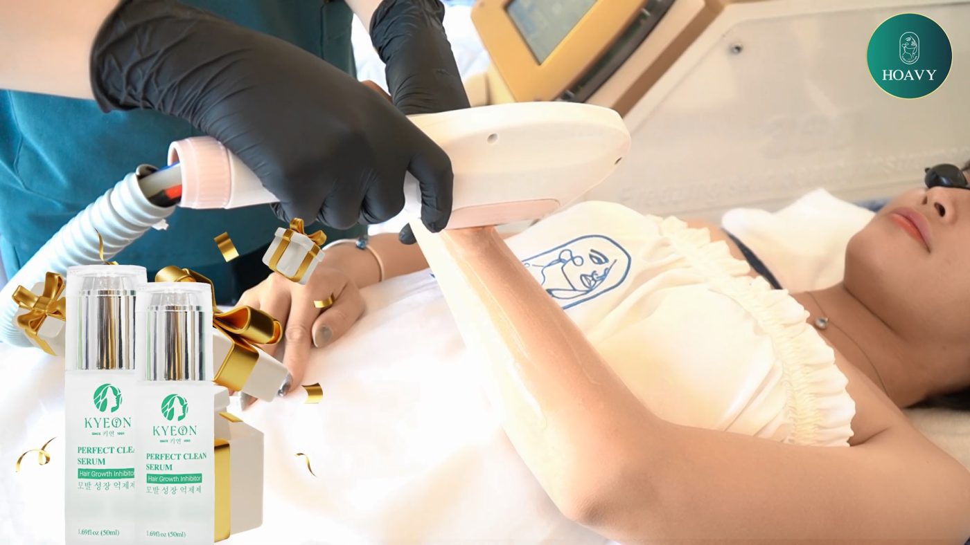 Triệt lông tại Thẩm mỹ viện Hoa Vy giúp loại bỏ lông nhanh chóng, mang lại làn da sáng mịn