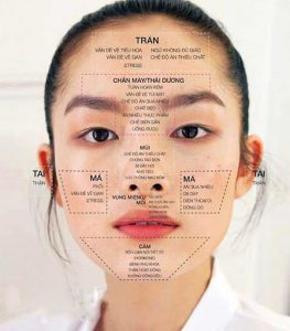 Bản đồ mụn trên khuôn mặt