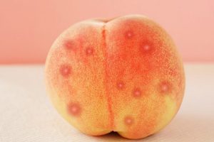 Mụn nhọt thường tập trung ở mông