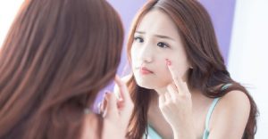 cách trị mụn ở tuổi dậy thì nữ