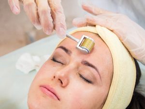 Lăn kim trị sẹo rỗ từ khi ra đời cho đến nay đã đem đến giải pháp cải thiện nhanh sắc da mặt cho hàng triệu người nam và cả nữ giới