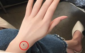 Nốt ruồi ở cánh tay trái của nữ tượng trưng cho những điều may mắn
