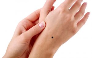 Nốt ruồi ở cổ tay gần phần mu thể hiện điềm xấu