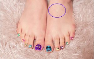 Nốt ruồi mọc trên mu bàn chân thường mang ý nghĩa xấu