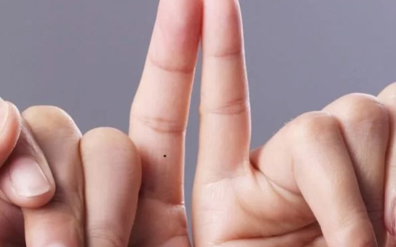 Nốt ruồi ở ngón út là dấu hiệu cho những người có vận mệnh tươi sáng