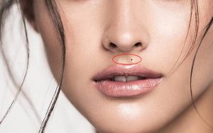 Người có nốt ruồi ở bên phải đường nhân trung thường rất thân thiện, dễ mến