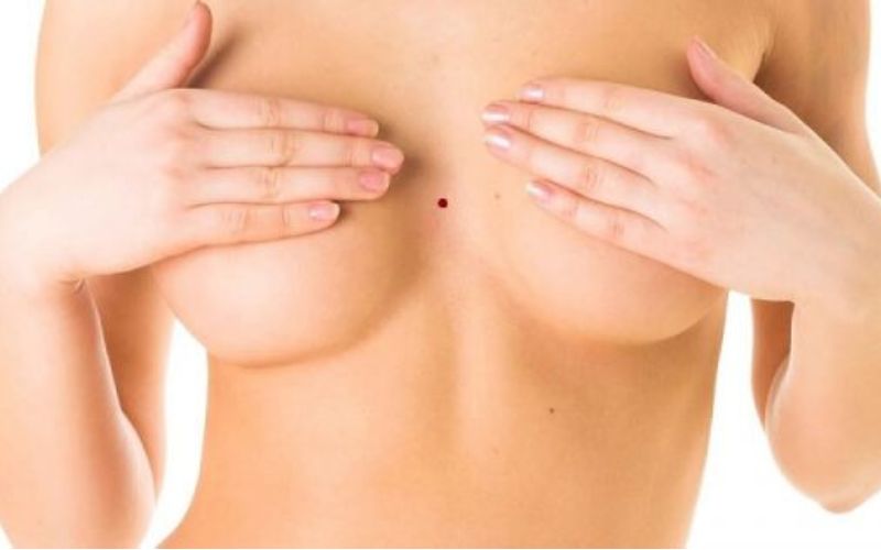 Nốt ruồi son ở khe ngực phụ nữ