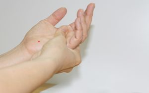 Nốt ruồi son trong lòng tay trái của nam giới có ý nghĩa lớn về tính cách