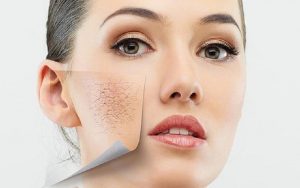 Lớp nền bị mốc sẽ khiến da mặt trông sần sùi, không đều màu, mất thẩm mỹ
