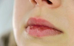 Chọn đúng địa điểm phun môi cũng là một cách để bạn bảo vệ bản thân của mình