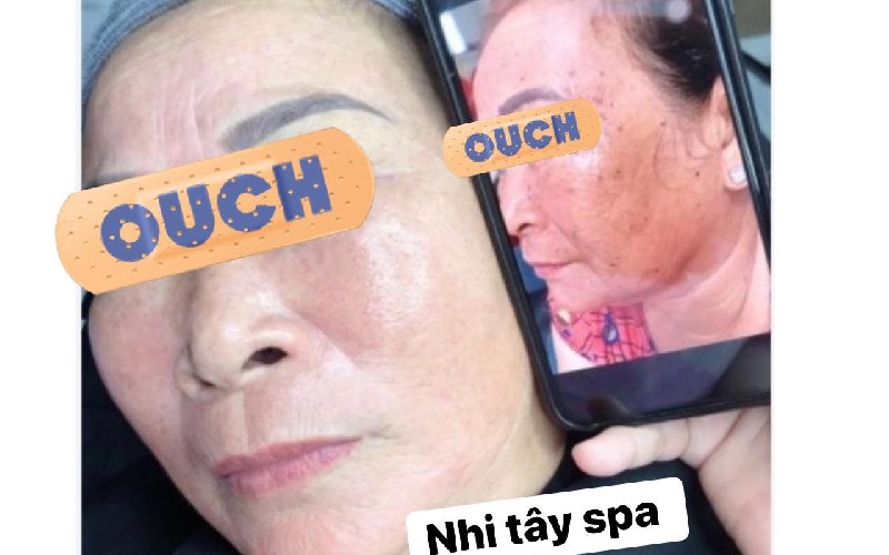 Đến Dr. Huệ Spa & Clinic, khách hàng được bác sĩ thăm khám và tư vấn liệu trình