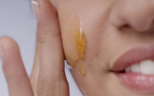 Serum triệt lông liệu có hiệu quả như lời đồn