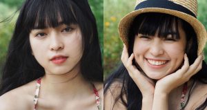 Má lúm đồng tiền 2 bên có ý nghĩa gì?