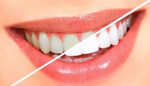 Môi sau phun rất nhạy cảm nên bạn cần phải cẩn thận trong quá trình vệ sinh