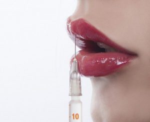 Tiêm filler môi giúp uốn nắn, thay đổi dáng môi