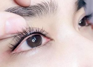 Không phải ai cũng phù hợp với phương pháp nhấn mí mắt